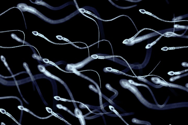 Espermatozoides. 