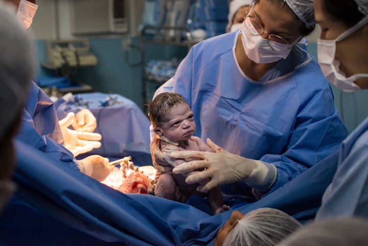 Kuntsmann's viral birth photo quickly became a meme. 