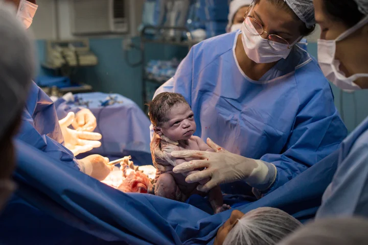 Newborn Baby Makes Epic Face In Viral Birth Photo Huffpost Life