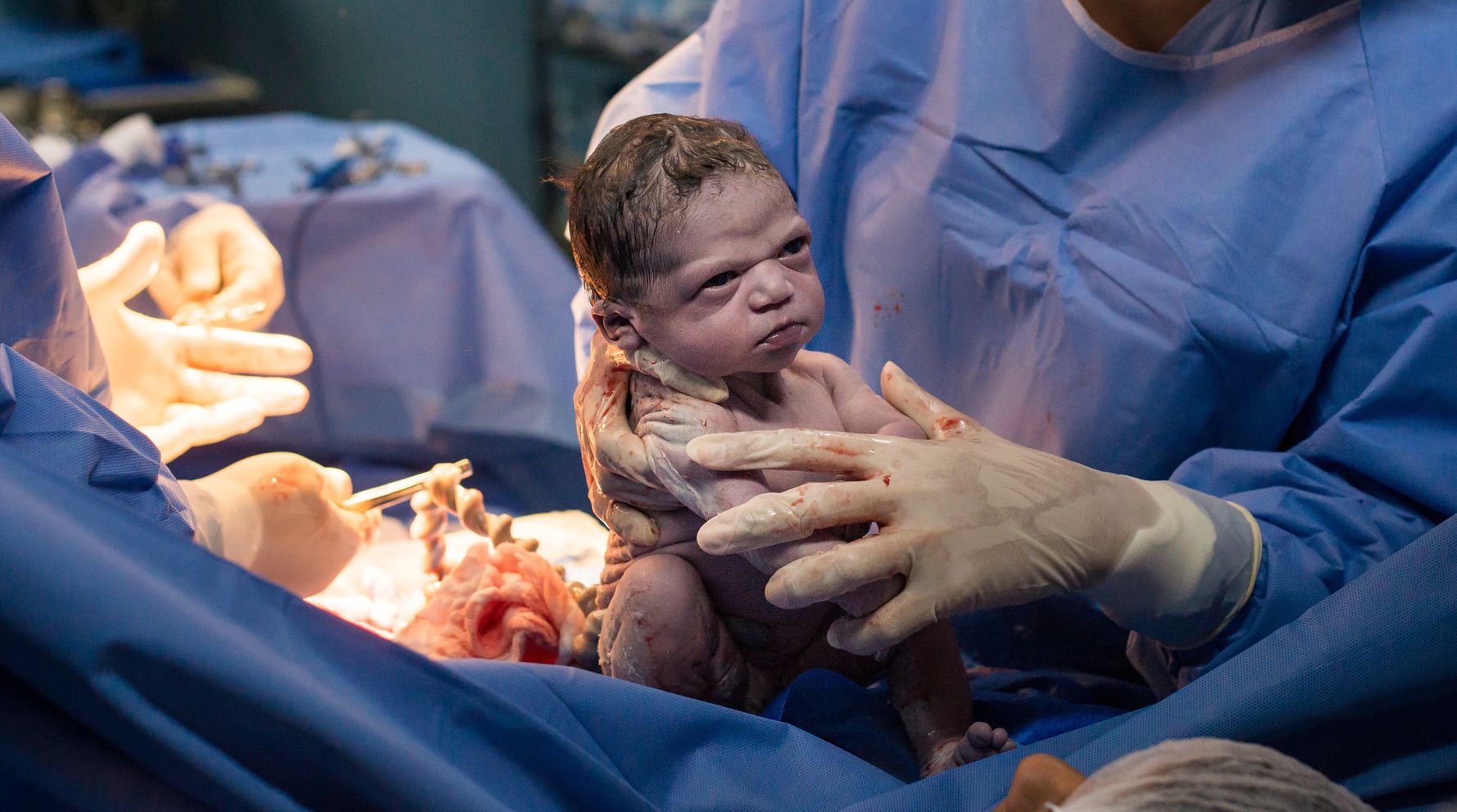 Newborn Baby  Makes Epic Face In Viral Birth  Photo 
