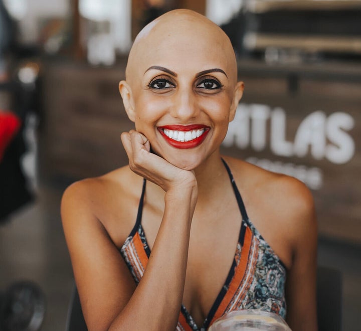 Supriya Surender writes about alopecia at her blog Baldie Boo.