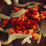 4 Alberta Patients In Self-Isolation Following Presumed COVID-19