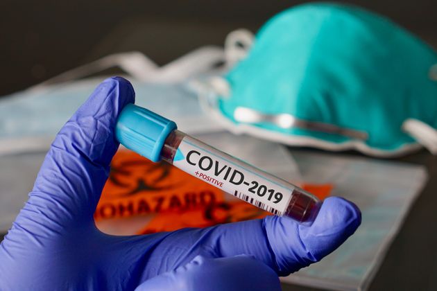 Pour trouver un vaccin au coronavirus, ce labo britannique cherche des volontaires | Le HuffPost