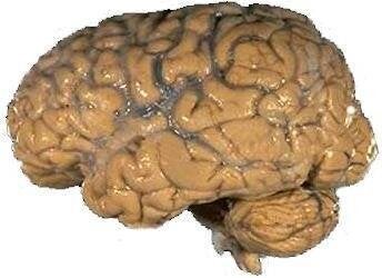 NIH image of human brain. Source: http://lbc. nimh. nih. gov/images/brain. jpg (found on page http://lbc. nimh. nih. gov/osit