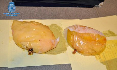 Cocaine Breast Implants PHOTO Released After Woman Smuggles Drugs