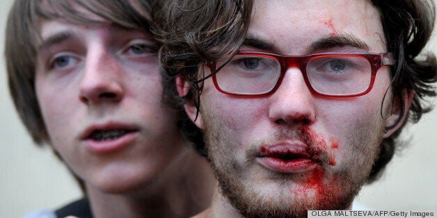 A gay rights activist is seen after clashes with anti-gay demonstrators during a gay pride event in St. Petersburg on June 29, 2013. Russian police arrested dozens of people on Saturday after clashes erupted in the city of Saint Petersburg between pro- and anti-gay demonstrators. AFP PHOTO / OLGA MALTSEVA (Photo credit should read OLGA MALTSEVA/AFP/Getty Images)