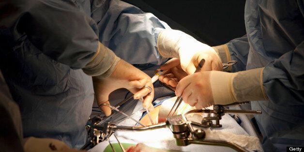 Transplant team making the right groin incision in the kidney recipient in preparation for a kidney transplant.