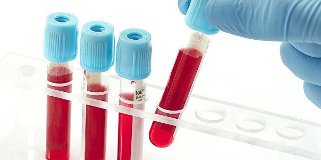 blood samples in a rack