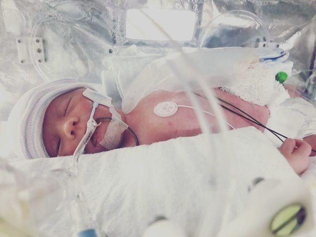 Bastian, under a month old, right before his second surgery in April 2019.