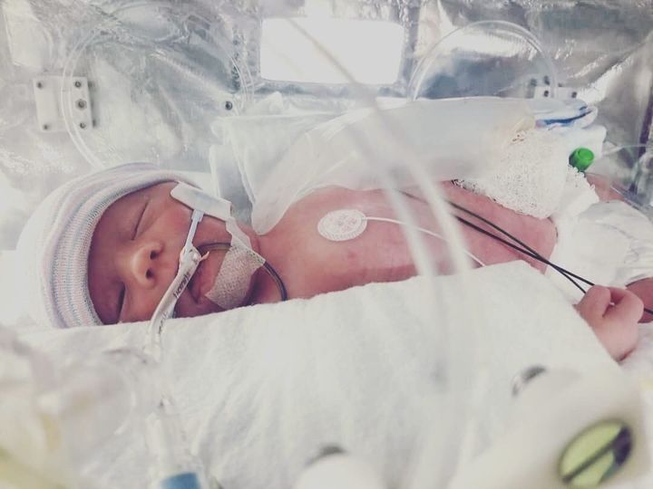 Bastian, under a month old, right before his second surgery in April 2019.