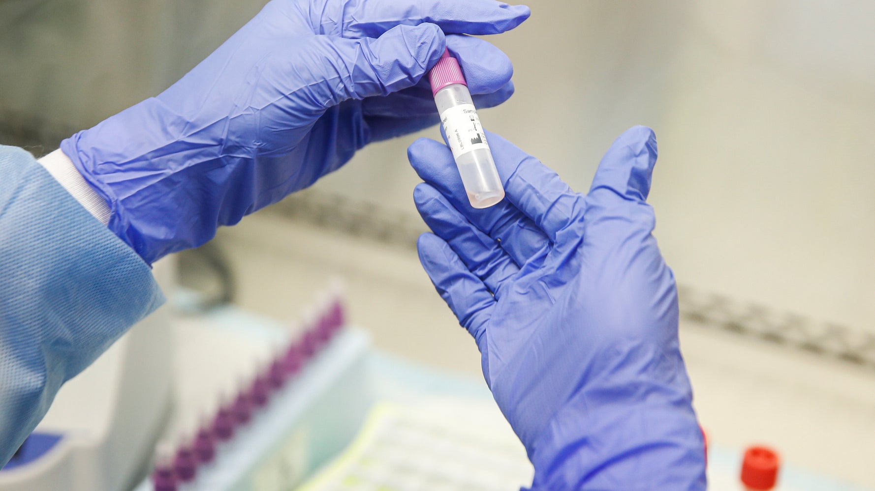 Li Produce Il Sangue Per Neutralizzare Le Tossine