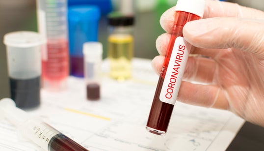 Coronavírus: Como ocorre a transmissão por pessoas infectadas mas sem