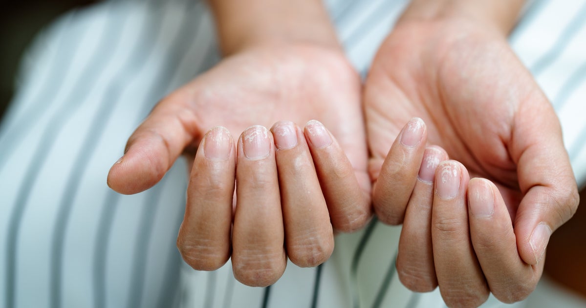 How To Properly Cut And Clean Nails To Fight Against Germs | HuffPost Life