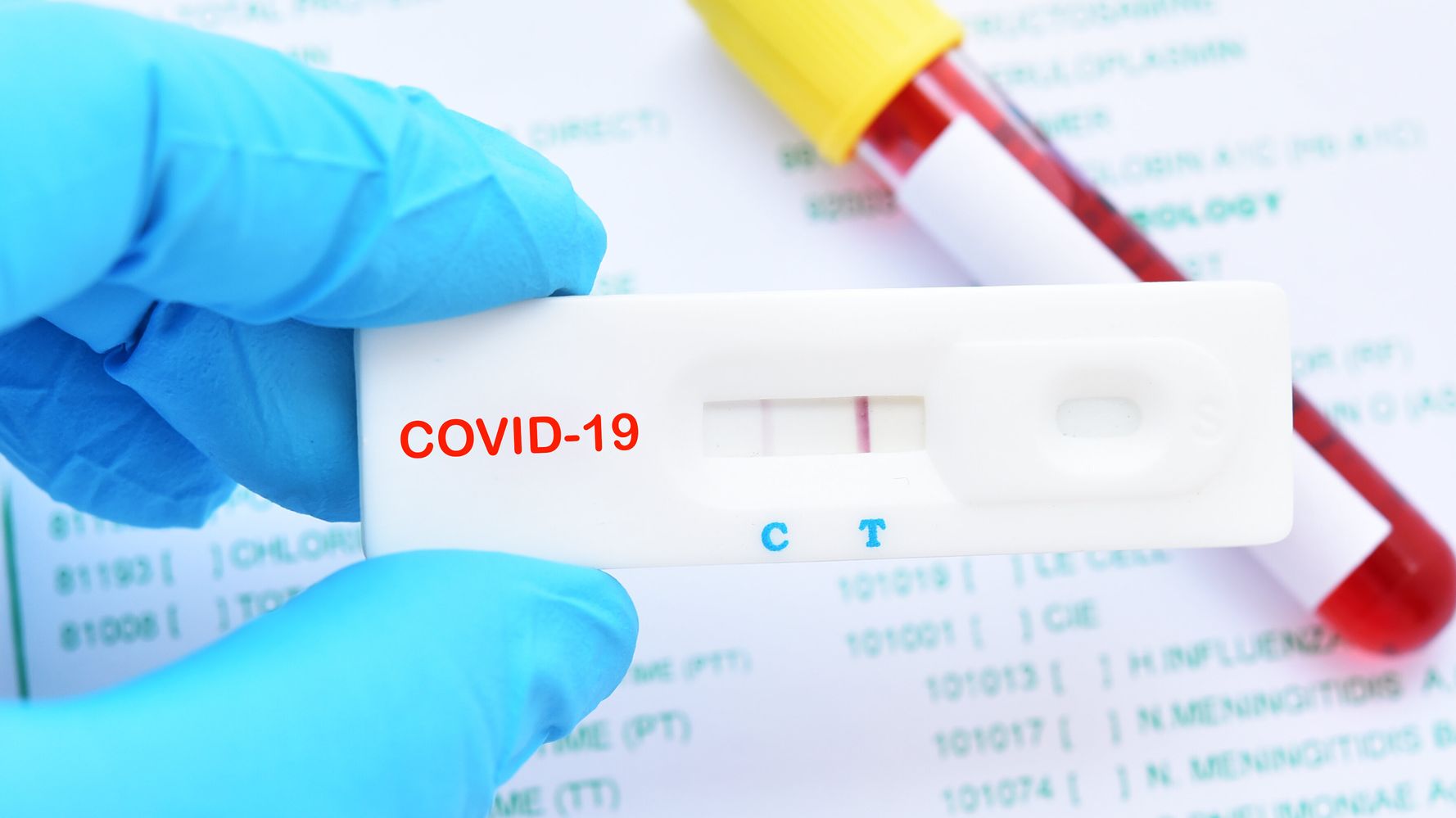 Cómo funcionan los test rápidos del coronavirus? | El HuffPost Life