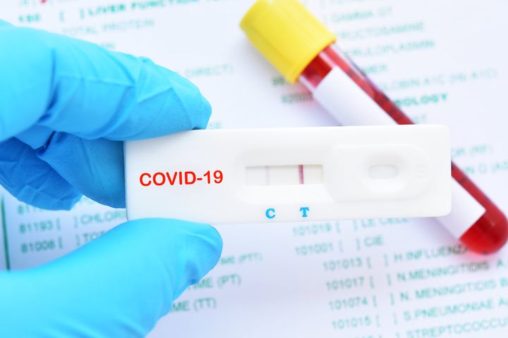 Como Funcionan Los Test Rapidos Del Coronavirus El Huffpost Life