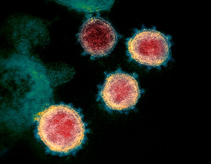 An electron microscope image made available by the US National Institutes of Health in February 2020 showing the coronavirus that causes Covid-19