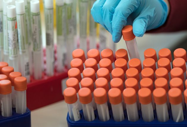 Les tests par PCR sont les plus courants. Chaque jour, environ 12.000 sont réalisés en
