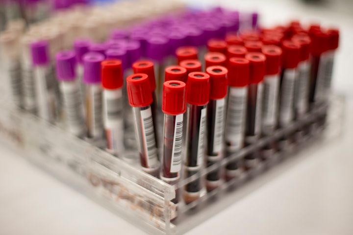 Vials are pictured at a Canadian Blood Services donation clinic in Toronto. 