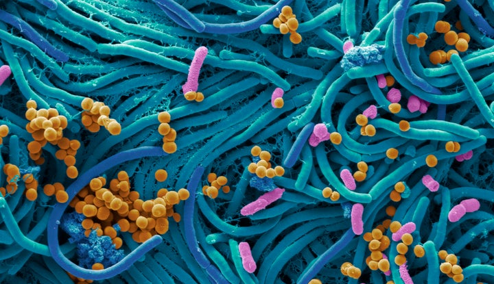 Imagen microscópica de un conjunto de bacterias en la superficie de un teléfono móvil.