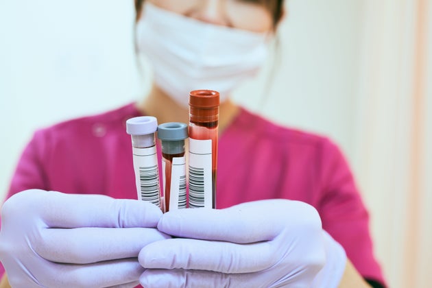 "Entro aprile test sierologico rapido su anticorpi". L