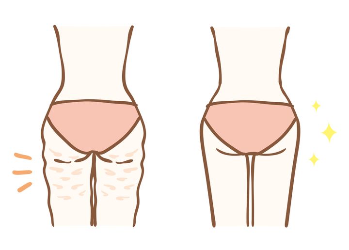 Anti-Cellulite Creams: Do They Really Work?