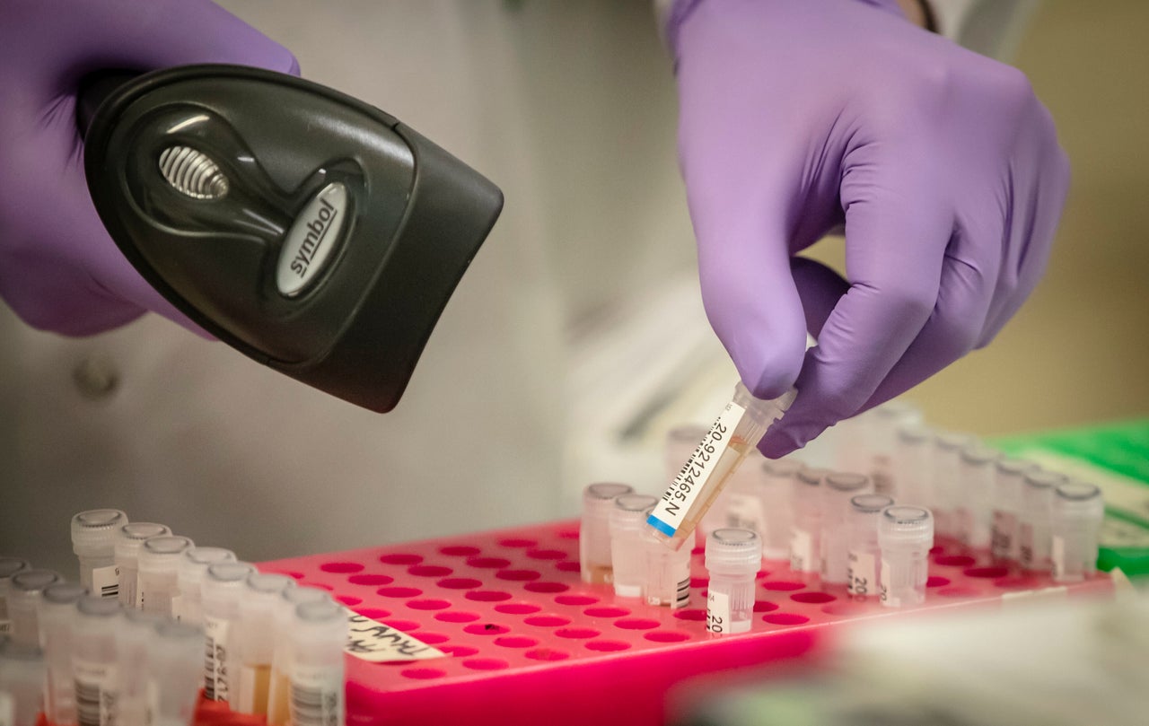 Samples are tested for respiratory viruses at a pathology lab 