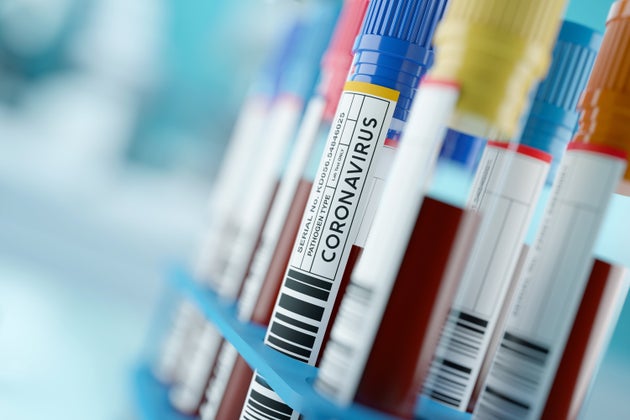 Antibody tests are giving us a snapshot of just how many people may have already been infected by the...