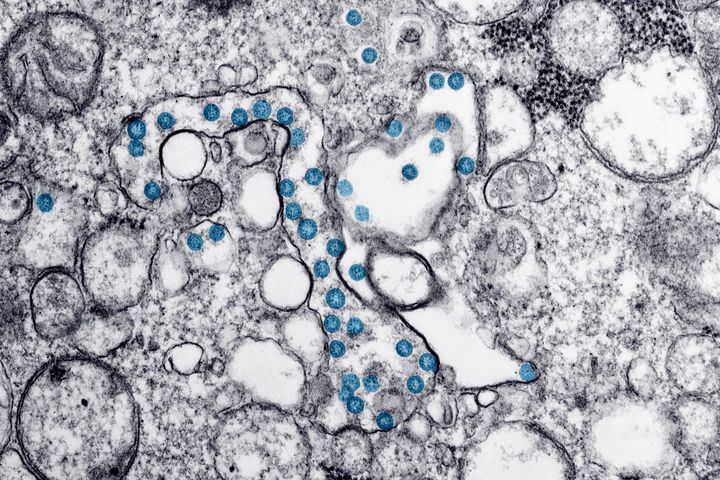 Ο νέος κορονοϊός υπό το μικροσκόπιο (CDC, ΗΠΑ)