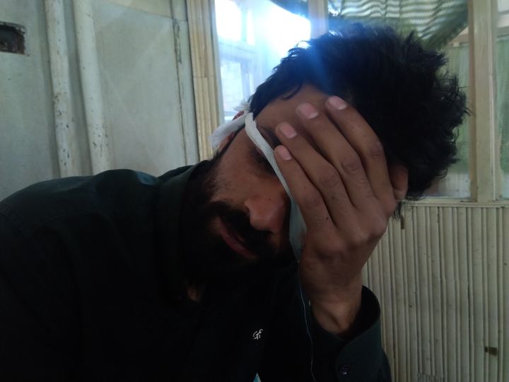 Showkat Ahmad Beigh, an engineering student, was hit by a pellet in left eye on 6 May, 2020 in Kashmir.