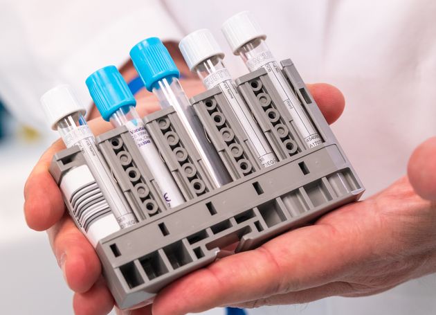 A lab technician holds a rackpack for the new serological antibody test in the Roche development lab.