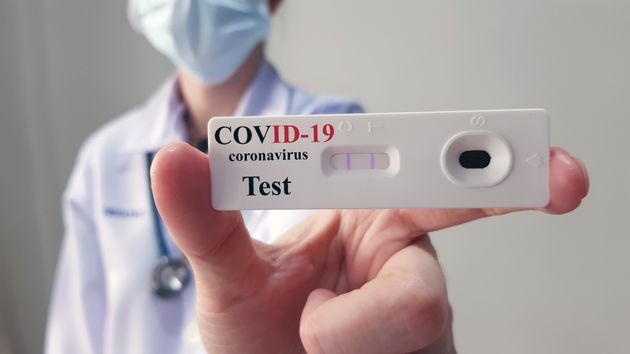 Coronavirus Antibody Test Will Certainly Be Available On The NHS, Says No.10