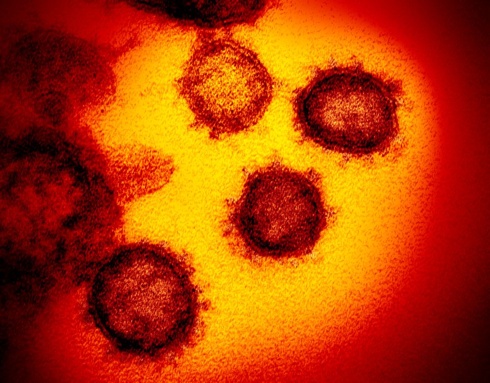 Εικόνα του ιού μέσω μικροσκοπίου (Εθνικό Ινστιτούτο της Υγείας, ΗΠΑ, Φεβαρουάριος 2020)