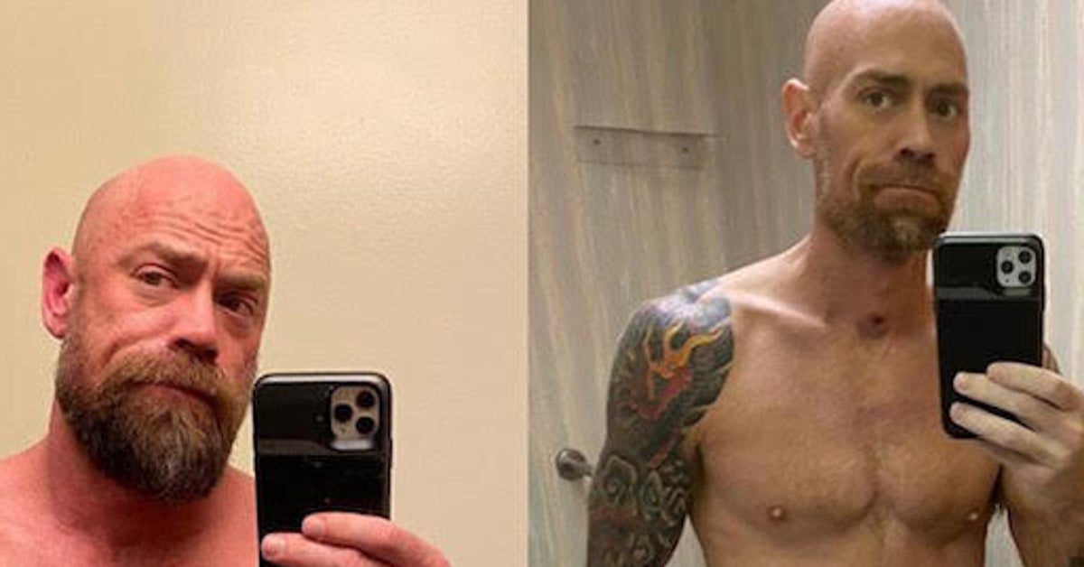 Nurse Who Survived COVID-19 Shares Jaw-Dropping Photo Of What It Did To His Body - HuffPost thumbnail