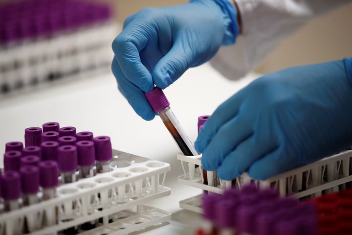 A staff member works on coronavirus serology tests at the Biogroup-LCD laboratory's technical platform in Levallois-Perret, near Paris, France.