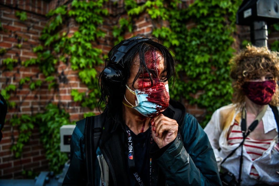 A journalist is seen bleeding after police started firing tear gas and rubber bullets near the 5th police precinct following a demonstration in Minneapolis on May 30, 2020.