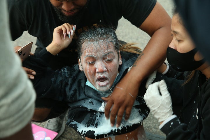 A woman who was hit with pepper spray had milk poured on her to ease the sting during a protest against police brutality and the death of George Floyd in Minneapolis, Minnesota.