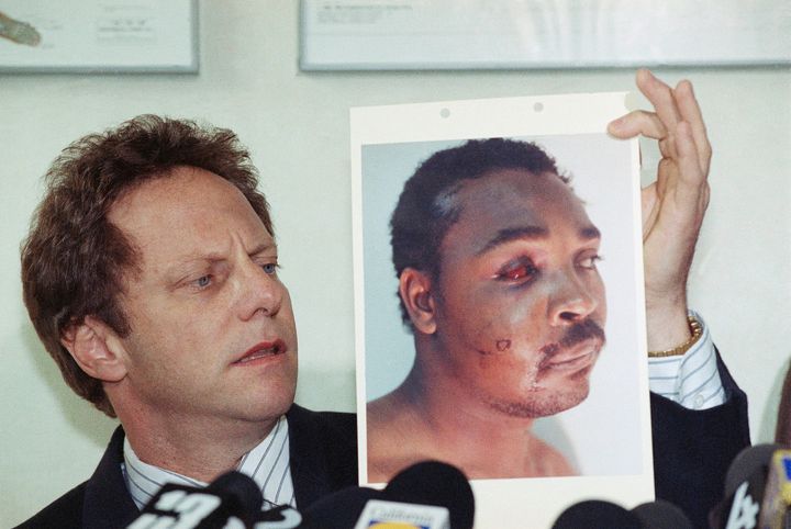 O δικηγόρος Στίβεν Λέρμαν κρατά φωτογραφία που δείχνει τα τραύματα που υπέστη ο Ρ.Κινγκ (1991)