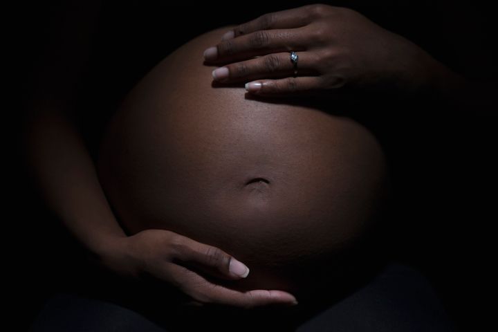 The Canadian health-care system is failing to track data around Black maternal health.