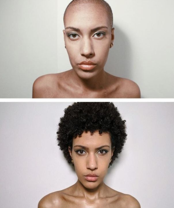 Self-portraits taken by the author in 2018, during treatment for leukemia (top), and in 2020, afterward (bottom).