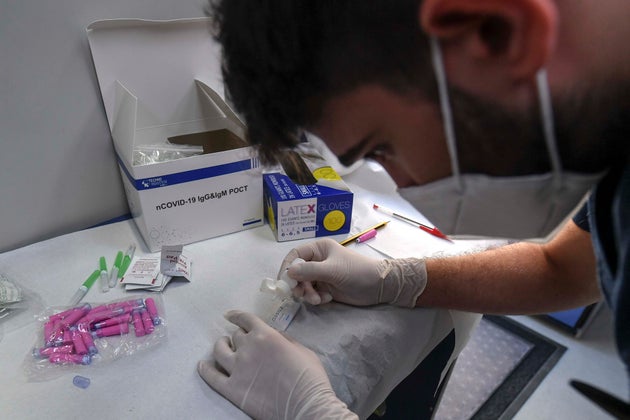 Γιατρός στη Νάπολη της Ιταλίας κατασκευάζει ένα τεστ για τον κορονοϊό.