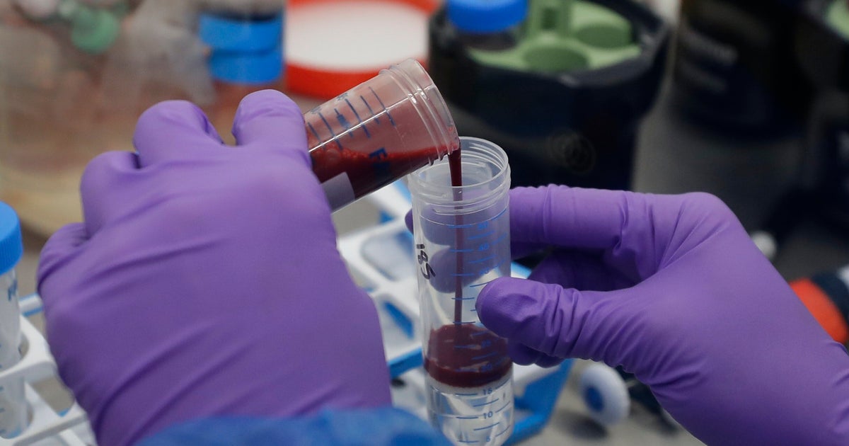 Lifesaving Coronavirus Treatment Dexamethasone Hailed As 'Major