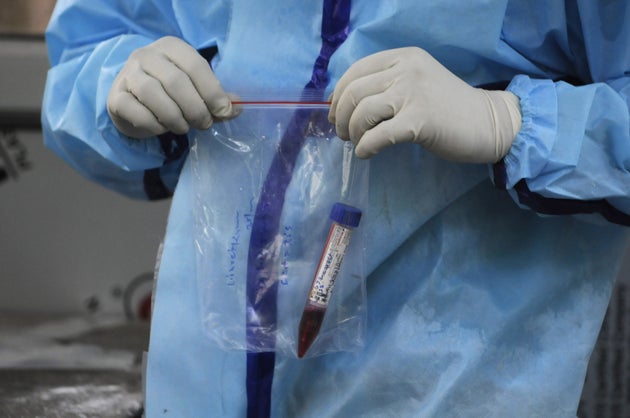 A medical professional holds a sample to be tested later for COVID-19
