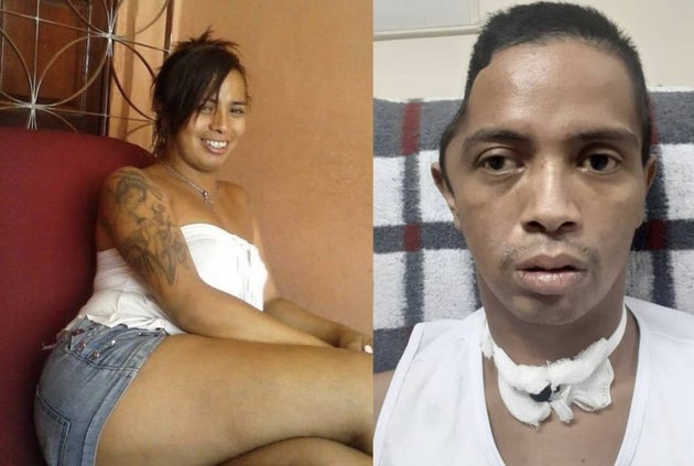 Cibelly do Pará antes e depois das