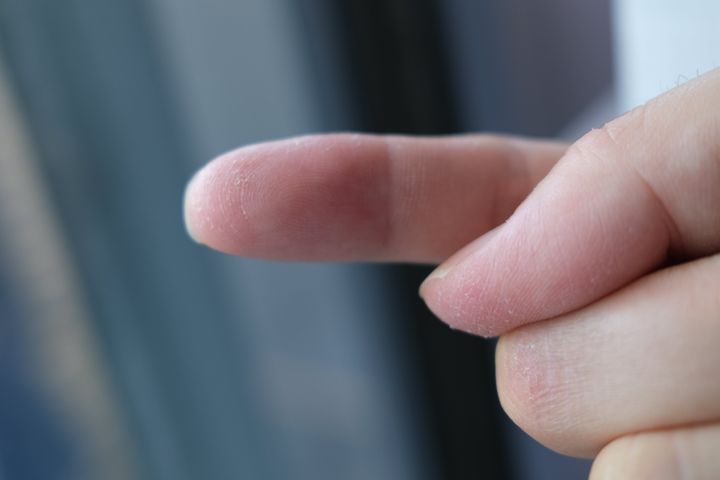 指紋が消えかかった筆者の指（5月30日撮影）