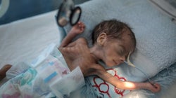 UNICEF: Εκατομμύρια παιδιά στην Υεμένη αντιμέτωπα με υποσιτισμό λόγω έλλειψης