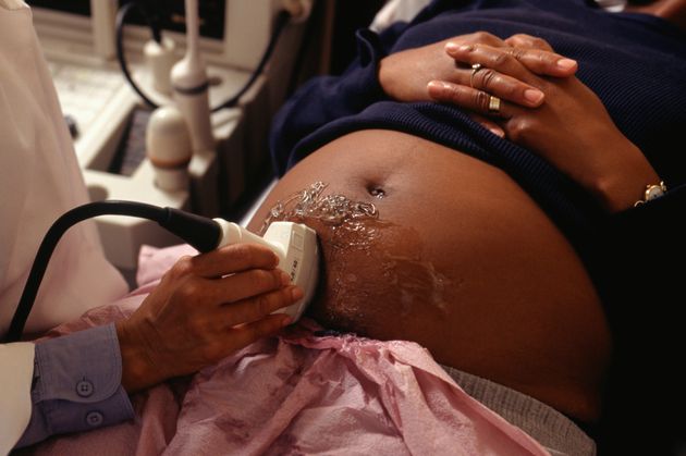 Pregnant Black And Ethnic Minority Women To Get Additional NHS Support