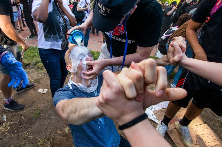 Milk is poured into a demonstrator's eyes to neutralize the effect of pepper spray during a rally at Lafayette Park near the 