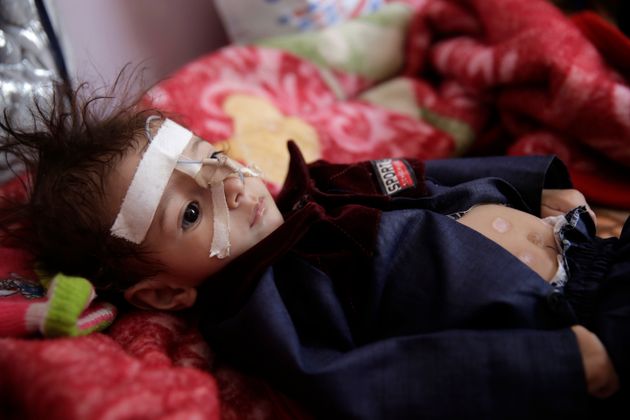 Υεμένη: Στην χώρα όπου αν δεν ευαισθητοποιηθεί ο κόσμος, θα πεθάνουν εκατομμύρια