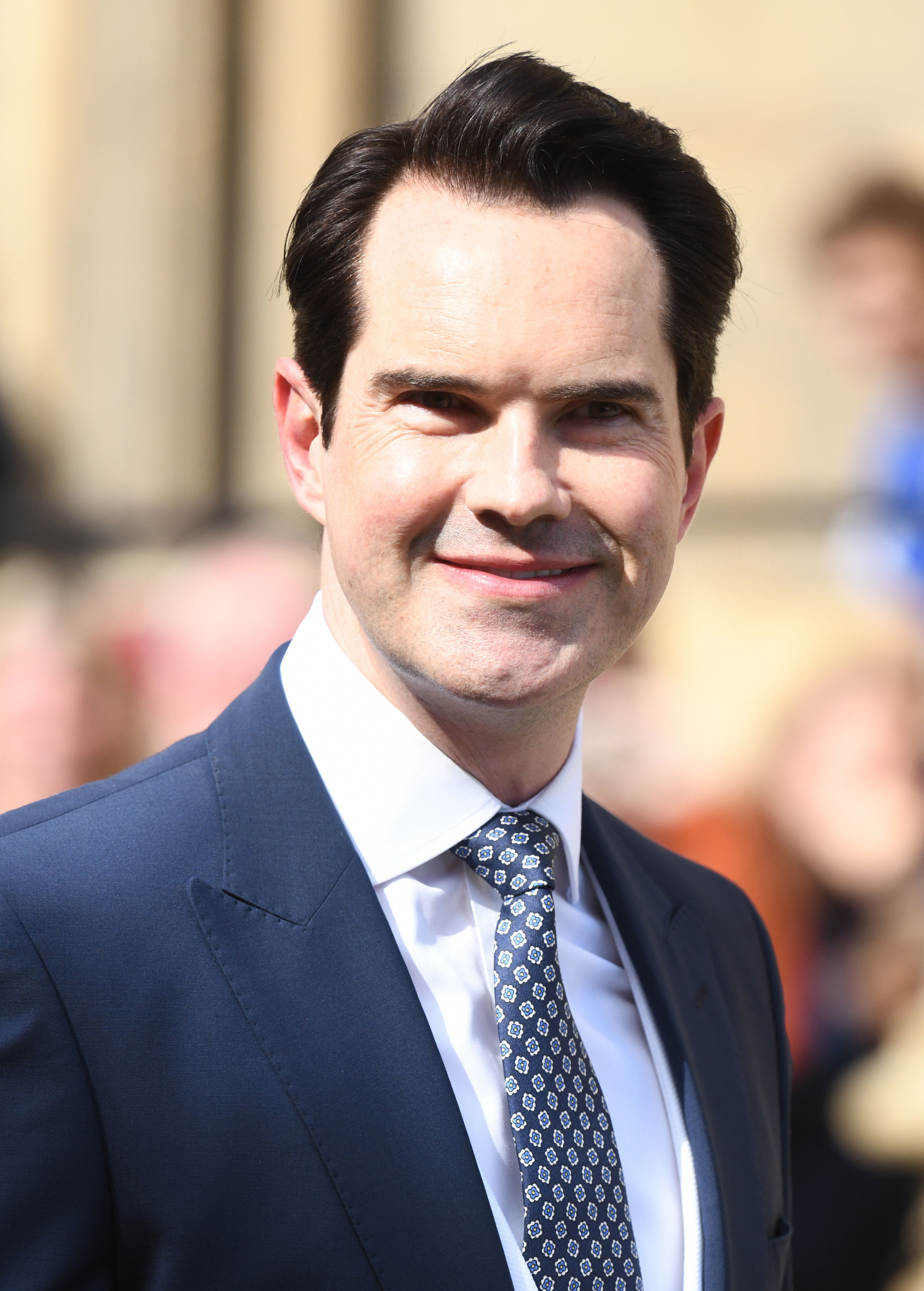 jimmy carr hair transplant