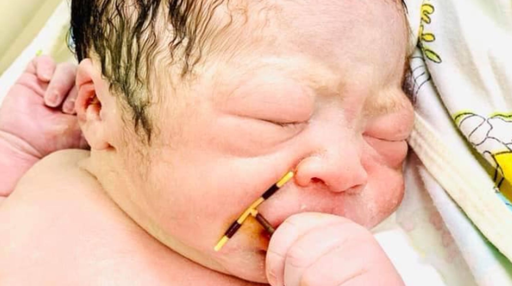 Un Bebe Nait Avec Le Sterilet De Sa Mere Une Situation Tres Rare Le Huffington Post Life